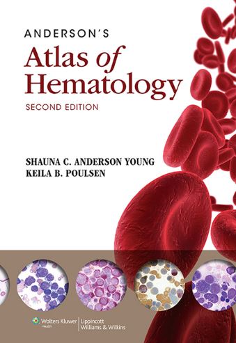 hematology atlas pdf